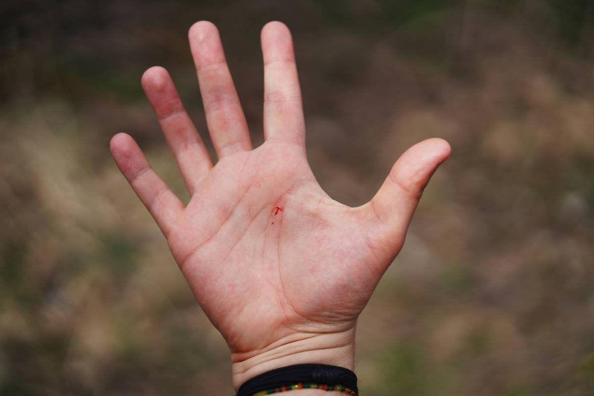 Mastering Hand Targeting for Shy Dogs: Unlock Their Confidence with Ease